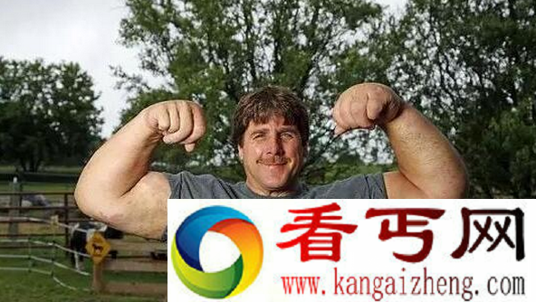 世界上胳膊最粗的人
