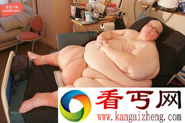 445公斤的世界最胖男子瘦身成功