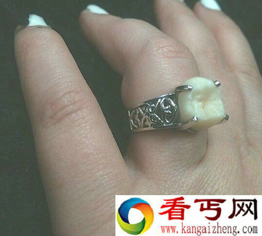 牙齿也能做成定婚戒  这样的戒指真的好吗