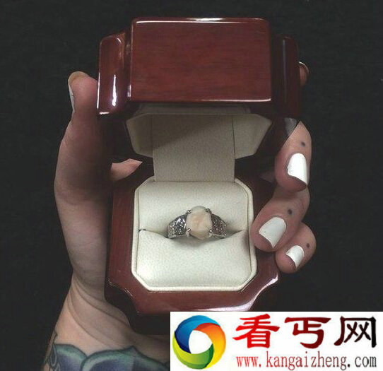 牙齿也能做成定婚戒  这样的戒指真的好吗