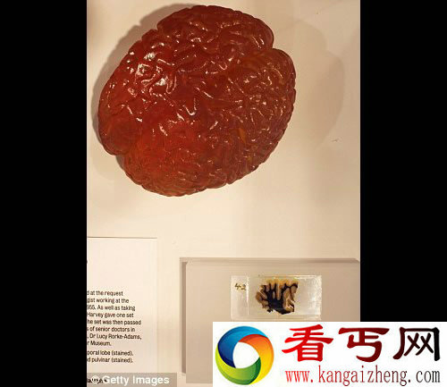 爱因斯坦大脑切片 在英国展出