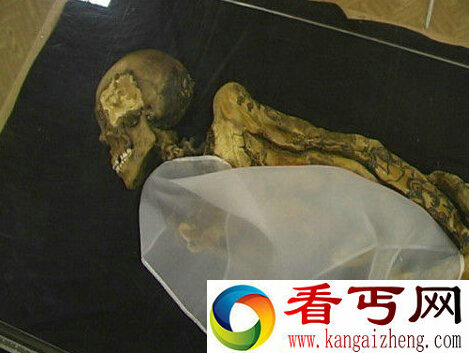 俄2500年前女性古尸死因查明吸食大麻过量还患乳腺癌