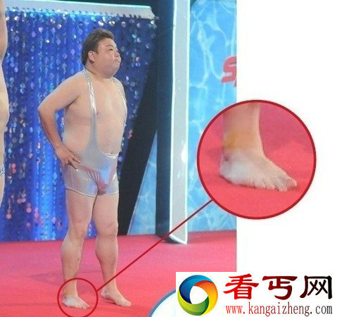 《中国星跳跃》有希腊脚正妹 体重108穿露点式洋装