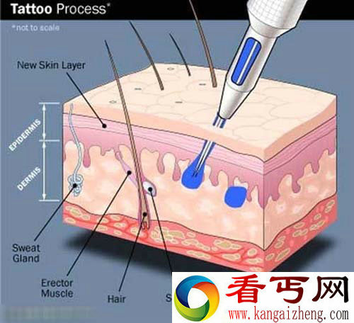 悲剧了！男子在其JJ上刺青导致永久性坚挺