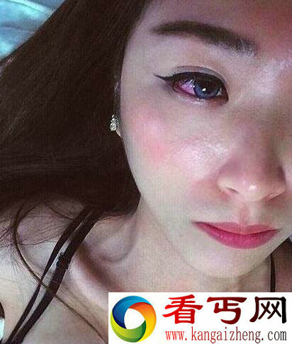 妹子疼么? 没想到按摩刮痧回来成这样了