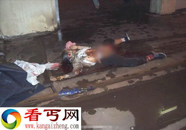 恐怖:妇女横过马路被机车勾穿腹部而亡