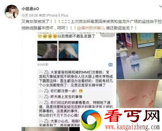 多名穿短裙女孩遭泼不明液体！腿部被灼伤