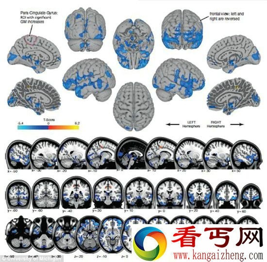 宇航员不能长期在太空飞行? 大脑会发生改变