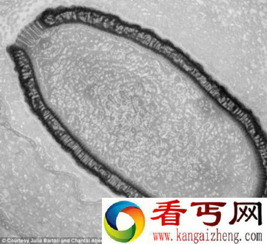 沉睡3万年恐怖病毒苏醒 潘多拉病毒仍具感染性