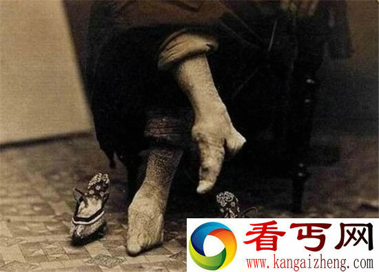 !古代封建社会下女子缠足