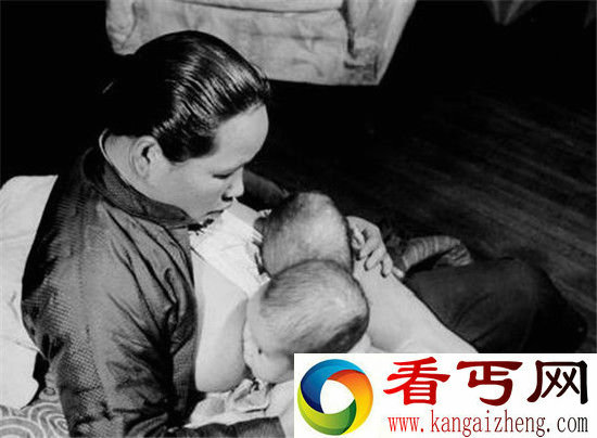 上海1947年连体婴 竟然被如此处理