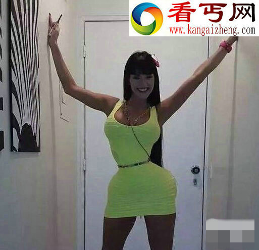 连体人姐妹曝光 人体之最令人毛骨悚然