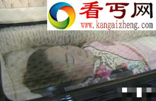 邓丽君怎么死的真相，生前遭打遗体有勒痕巴掌印