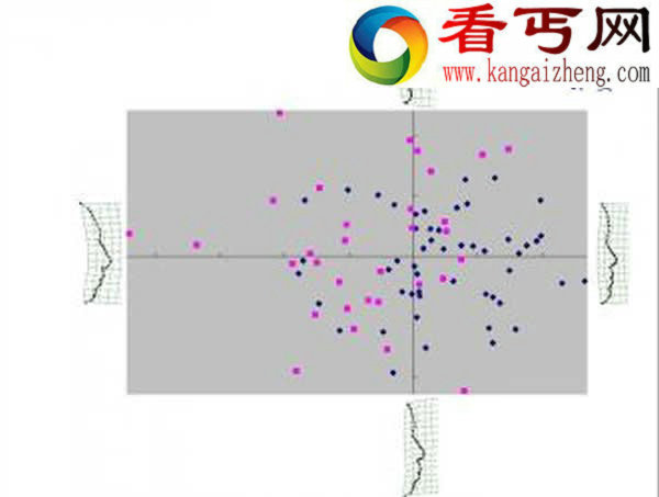 中国人面部几何形态初探 侧面轮廓形状及其变异