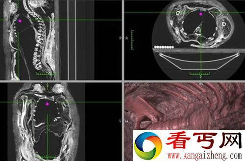 解密木乃伊制作鲜为人知的秘密