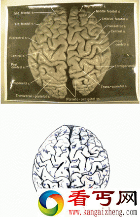 研究发现爱因斯坦大脑皮层 与正常人不同 