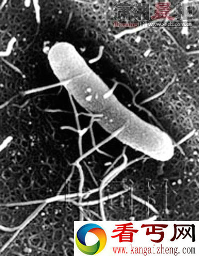 日本公布全球首张超级细菌照片