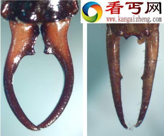 蠼螋(qú sōu)，能钻入大脑的杀人魔虫(谣言)
