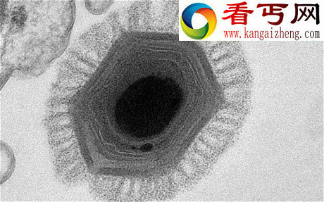 智利海底发现世界最大病毒 反常规让学界困惑