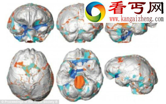 霍比人脑容量只有桔子大小