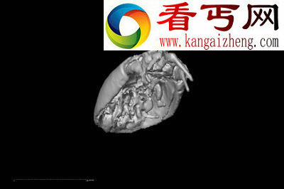 （图）科学家发现5000万年前蜘蛛身上跳蚤仅176微米