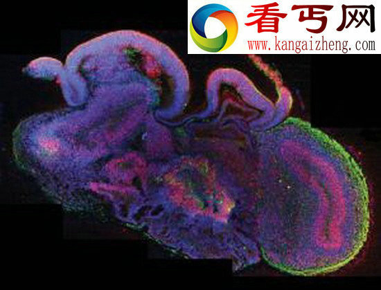 科学家培育微型人类大脑