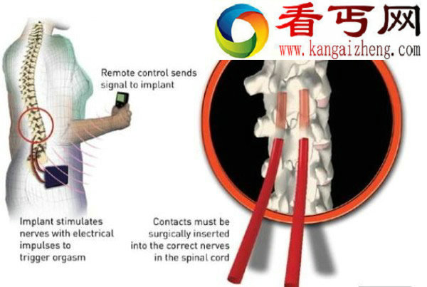 科学家发明女性高潮制造机