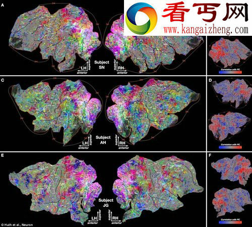 科学家绘制大脑结构图 清晰呈现大脑成像情况/图