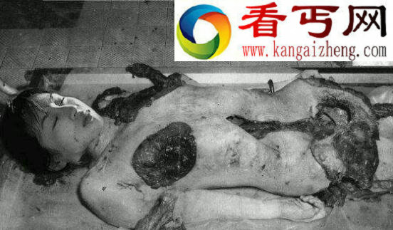 越战海豹人，女战俘四肢被截哭嚎求死(小说杜撰)