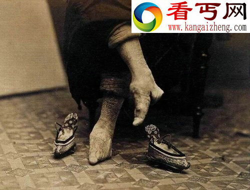 三寸金莲为古代女子最隐私的部位