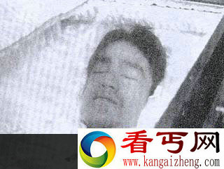 李小龙之死